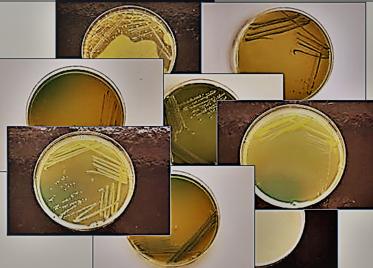 Acetic acid bacteria on the agar plates.